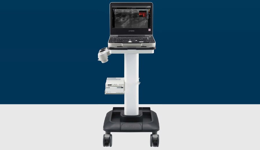 Alpinion X-CUBE i9 laptop ultrasound system on a rolling stand