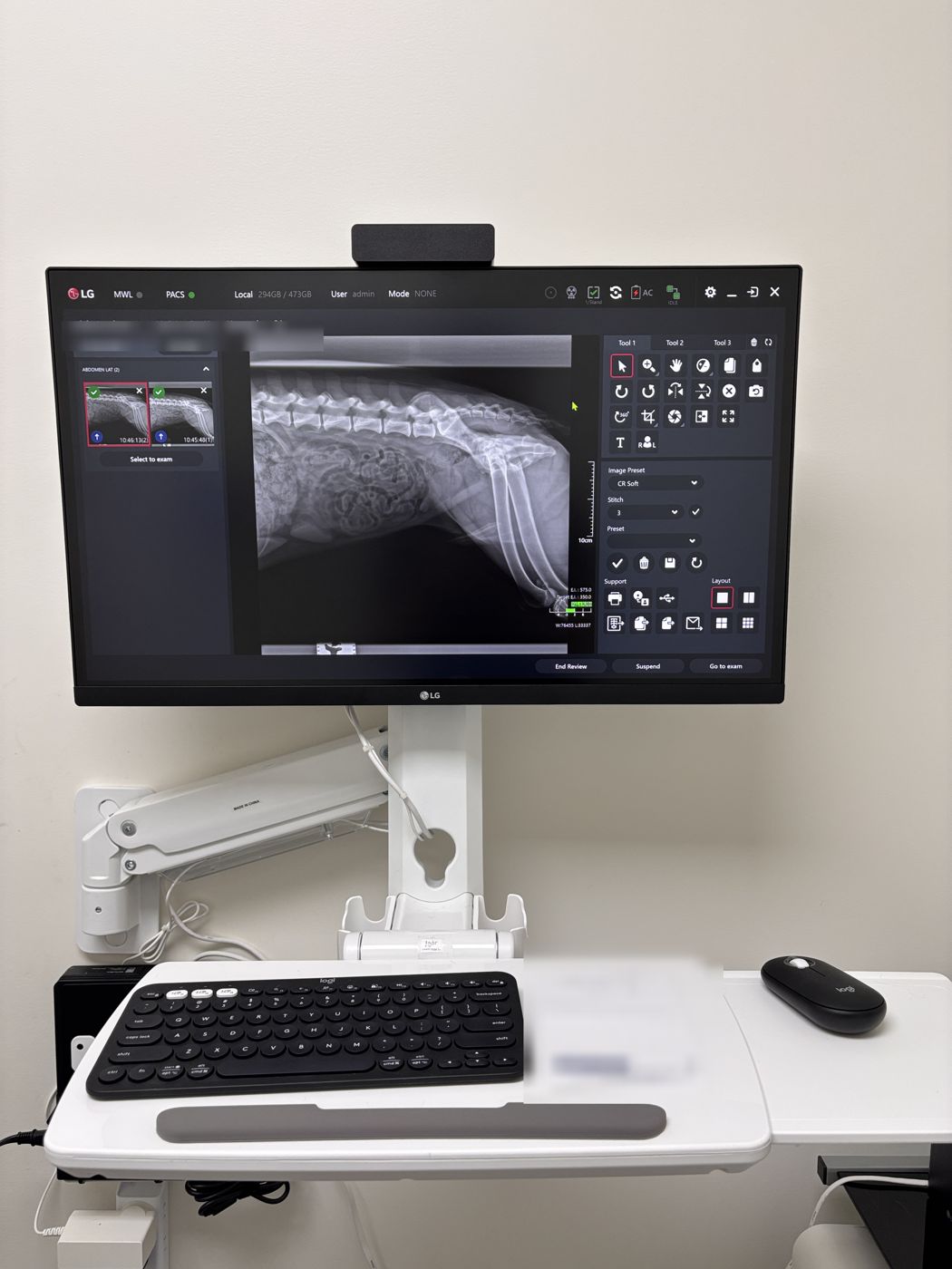 LG acquisition workstation installed next to an existing X-ray table